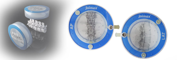 joimax Intracs em, navigation, endoscopic devices, electronic, patient mapper, ap, lateral, software view patientmapper