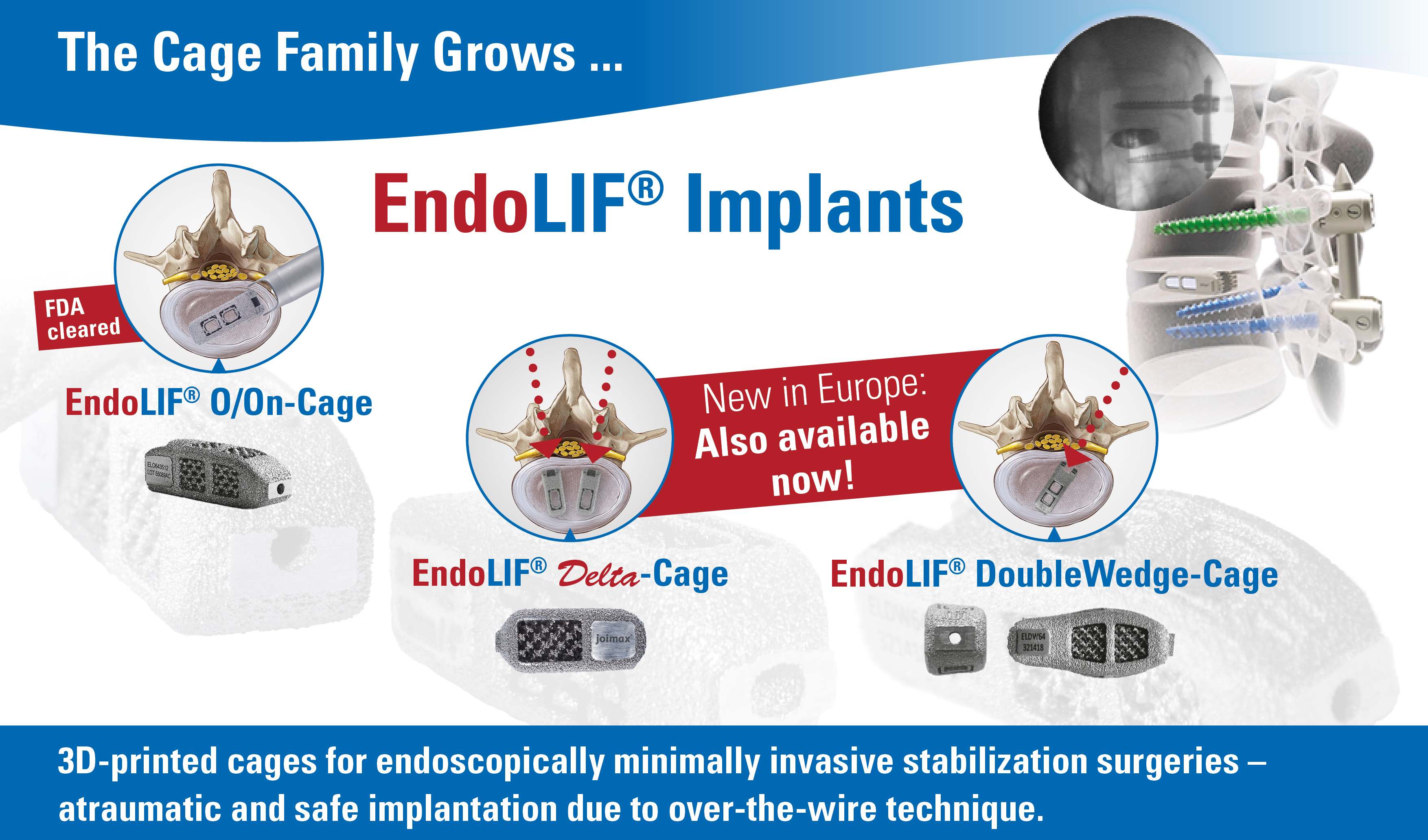 Endoscopic spine surgery, spinal stabilization, endolif, endoscopic device, full endoscopic, systems for stabilization 