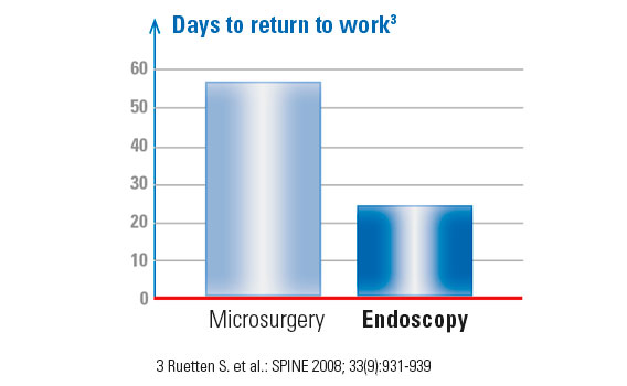 Content-herniated-disc-surgery-graphic-microsurgery-vs-endoscopy_568x350
