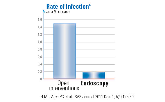 Content-herniated-disc-surgery-graphic-open-intervention-vs-endoscopy_568x350