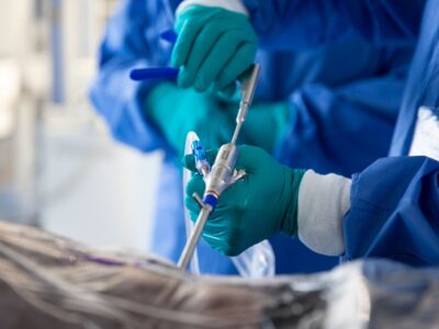 TESSYS Endoscope_cropped