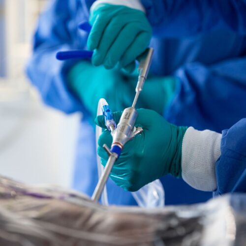 TESSYS Endoscope_cropped