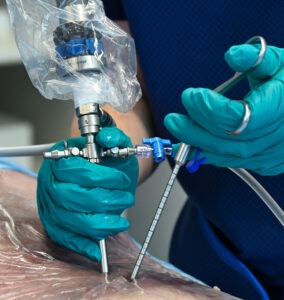 DSC_8140-2 Surgical approach performed with magnetic holding arm RoboFIX by Joimax.