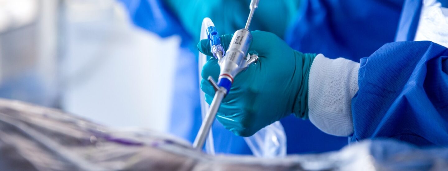 TESSYS-Slider TESSYS Endoscope by joimax in Action Transforaminal Access