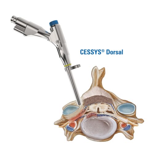 CESSYS-dorsal CESSYS-dorsal