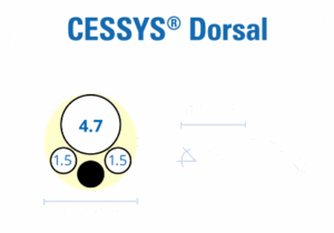 Cervical-CD-endoscopic-access-joimax-solutions-logos-endoscope-measurement-cessys-Dorsal