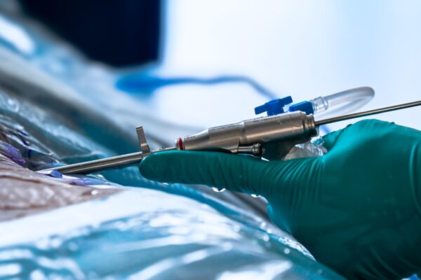 TESSYS Endoscope joimax