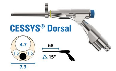 Endoskope_Zugaenge-endoskopische-wirbelsaulenchirurgie-Operation-CESSYS-dorsal (1)