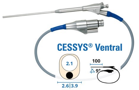 Endoskope_Zugaenge-endoskopische-wirbelsaulenchirurgie-Operation-CESSYS-ventral