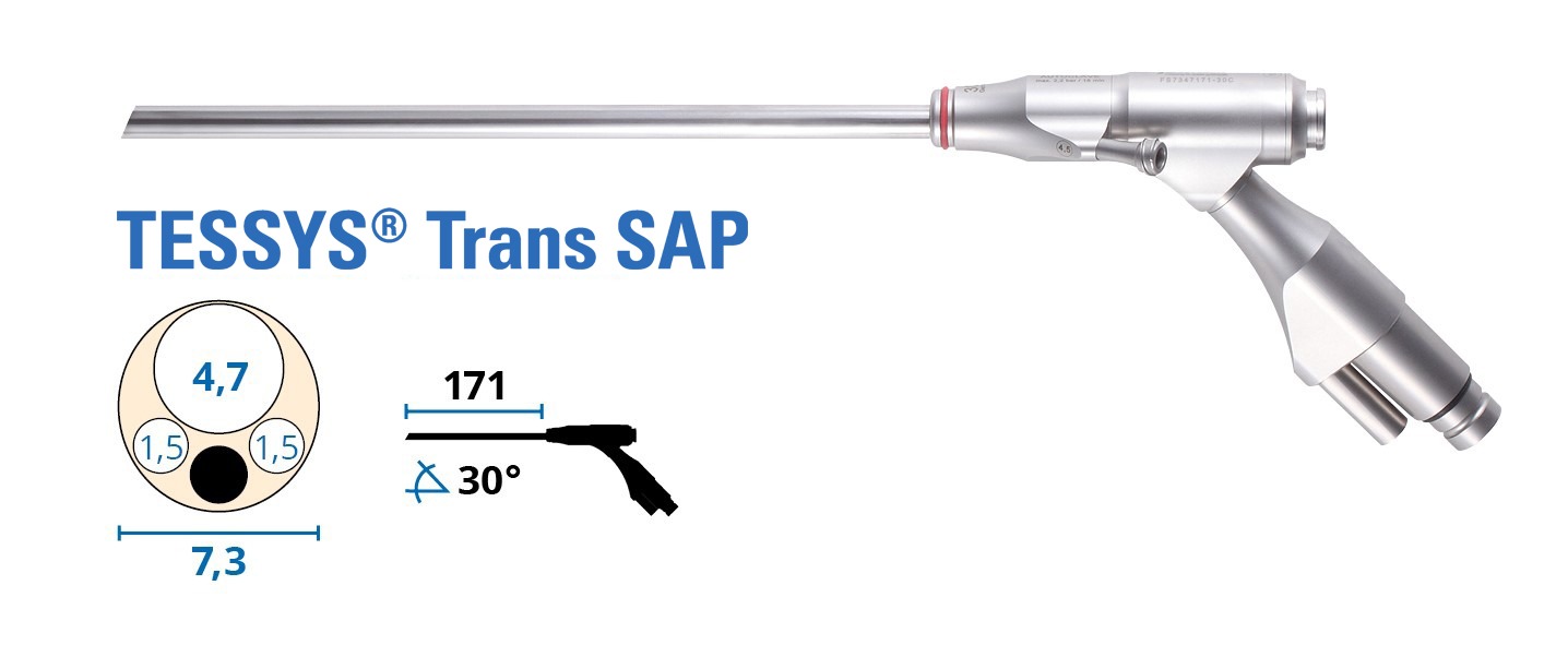 Endoskope_Zugaenge-endoskopische-wirbelsaulenchirurgie-Operation-TESSYS-transsap
