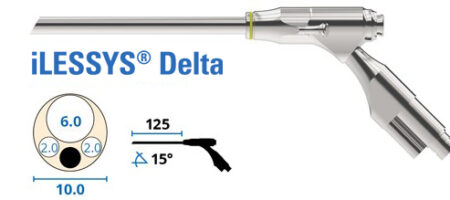 Endoskope_Zugaenge-endoskopische-wirbelsaulenchirurgie-Operation_ILESSYS-delta Endoskope_Zugaenge-endoskopische-wirbelsaulenchirurgie-Operation_ILESSYS-delta