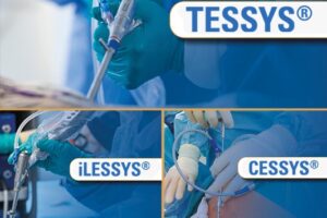 Produktübersichtvorlage_tessys ilessys cessys
