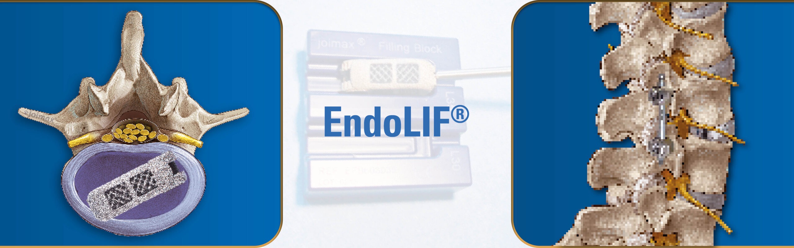 Slider-EndoLIF