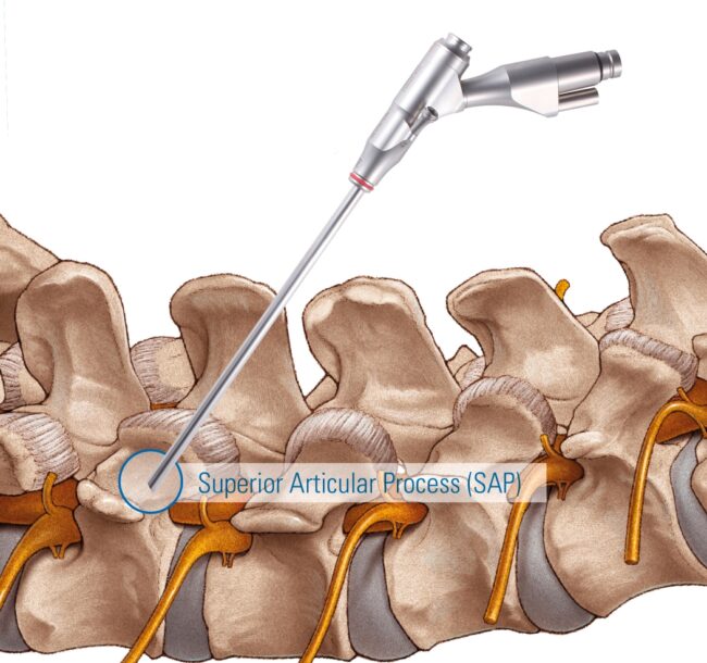 TESSYS TransSAP TESSYS TransSAP