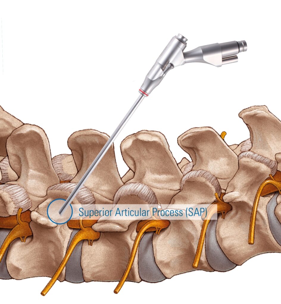 TESSYS TransSAP TESSYS TransSAP