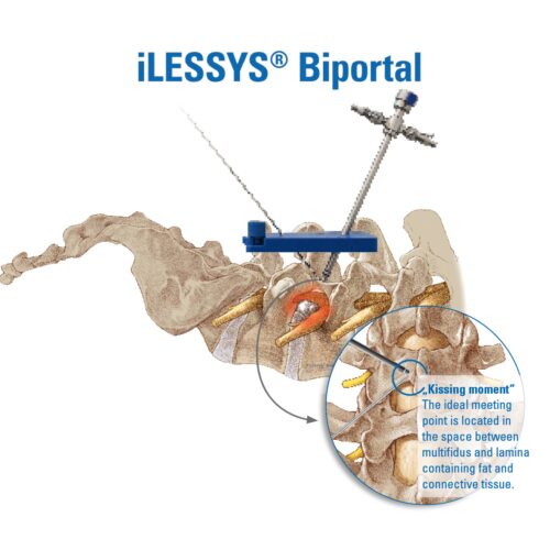 iLESSYS-Biportal-Access