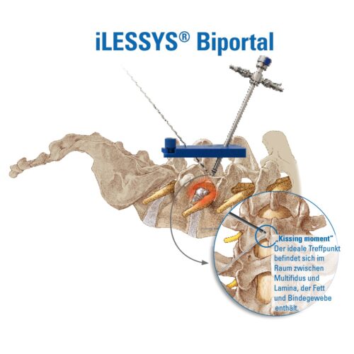 iLESSYS-Biportal-Zugang