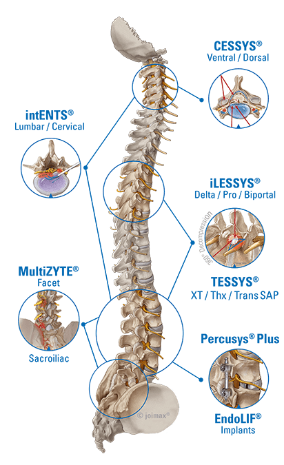 Spine joimax anatomical Spine Graphic showing all endoscopic Systems