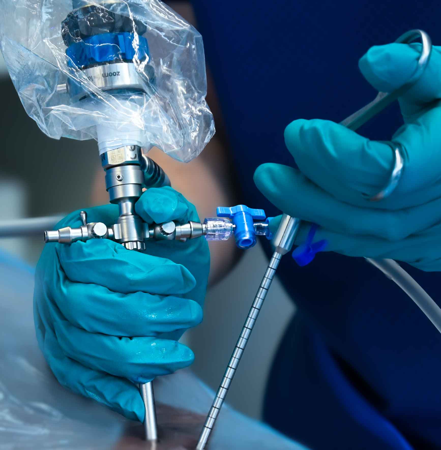 iLESSYS® Biportal by joimax® biportal interlaminar surgical approach performed with endoscope and forceps of iLESSYS® Biportal by joimax®.