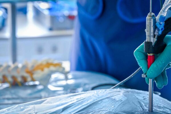 ilessys endoscope in action with an anatomical human lumbar spine model in the background for endoscopic spine surgery by joimax