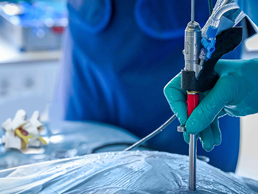ilessys endoscope in action with an anatomical human spine model in the background for endoscopic spine surgery by joimax