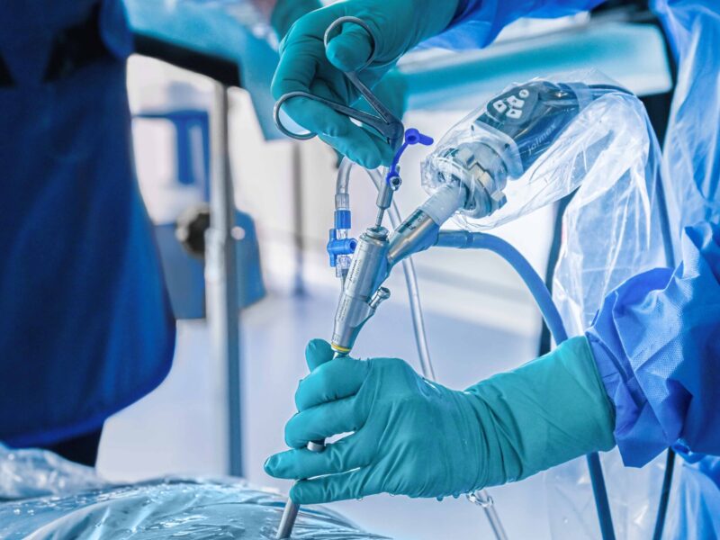 iLESSYS_In-Action joimax iLESSYS endoscope in action in the OR connected to the camsource Duo Camera head for endoscopic spine surgery by joimax